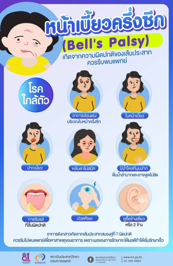 "หน้าเบี้ยวครึ่งซีก Bell's Palsy ความผิดปกติของเส้นประสาท ควรรีบพบแพทย์"